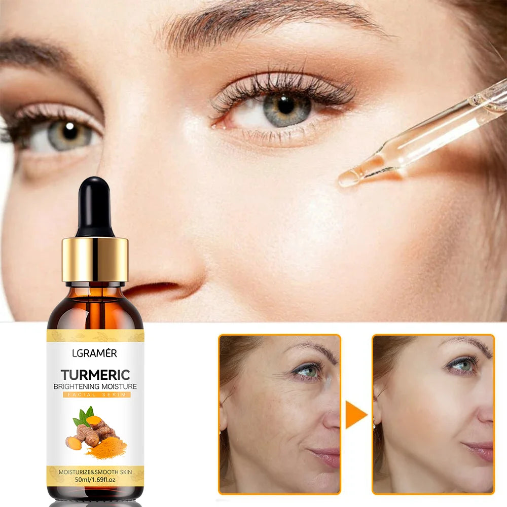 Turmeric Freckle Whitening Serum Anti-Oxidant Nourishing Moisturizing Repair Skin Brighten Fade Dark Spot Essence Face Care