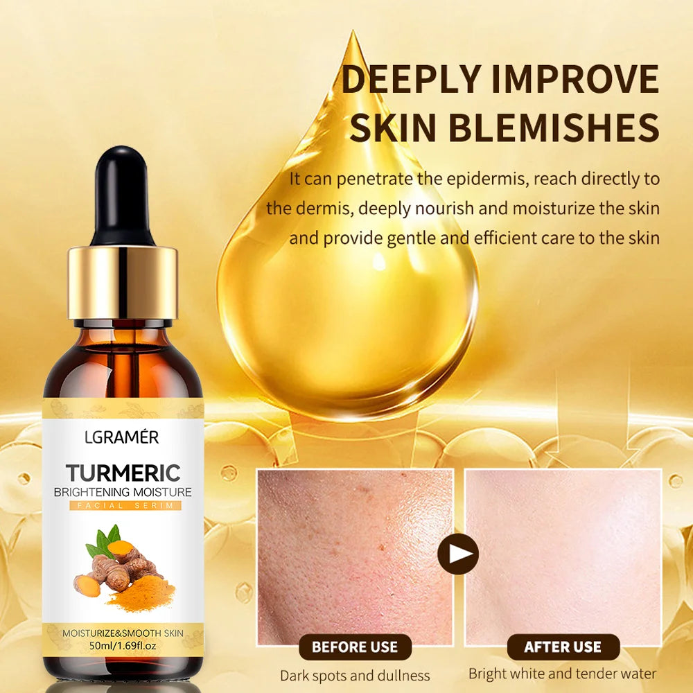 Turmeric Freckle Whitening Serum Anti-Oxidant Nourishing Moisturizing Repair Skin Brighten Fade Dark Spot Essence Face Care